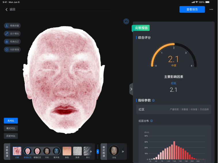 美际3D皮肤分析仪P2发布，引领行业新风潮  第10张
