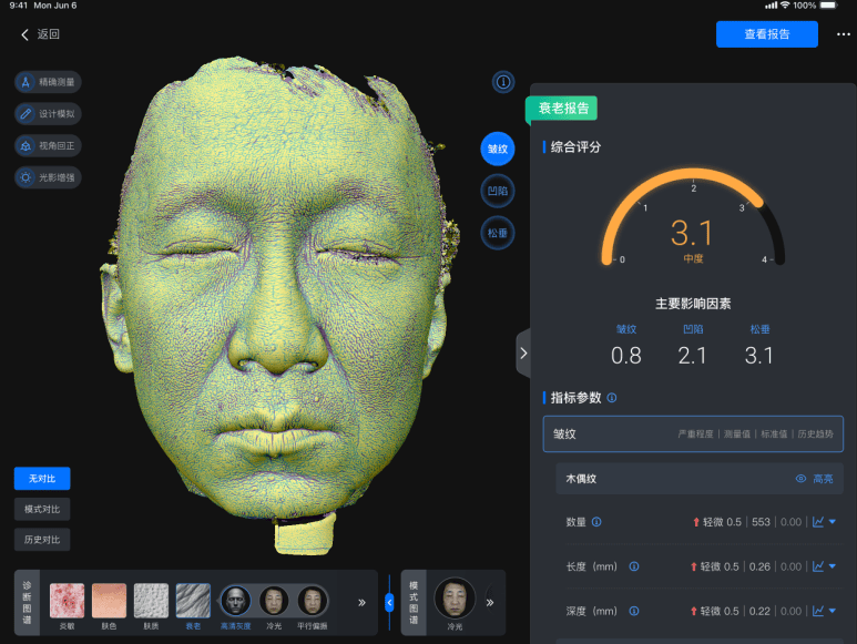 美际3D皮肤分析仪P2发布，引领行业新风潮  第13张